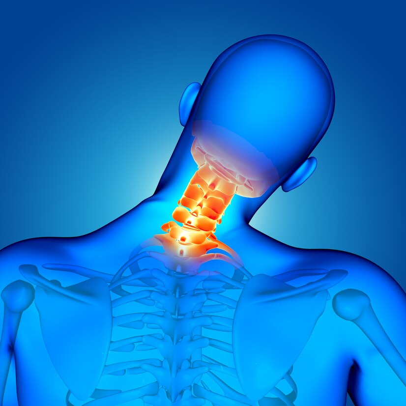 Stem Cell Treatment for Neck Pain