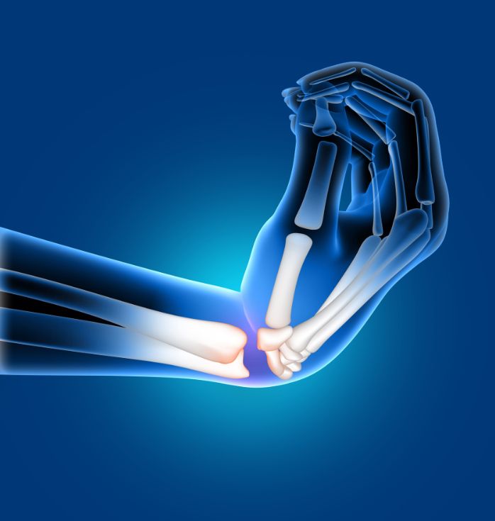 Stem Cell Treatment for Arthritis