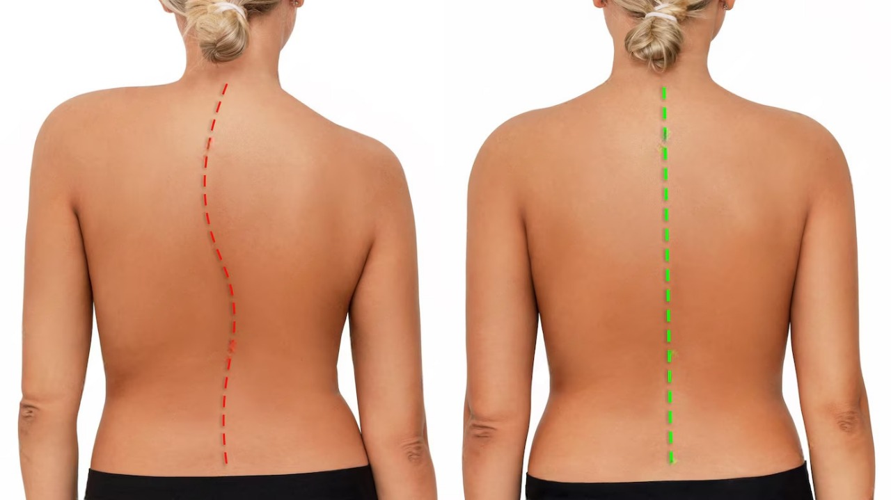 stem cell back treatment