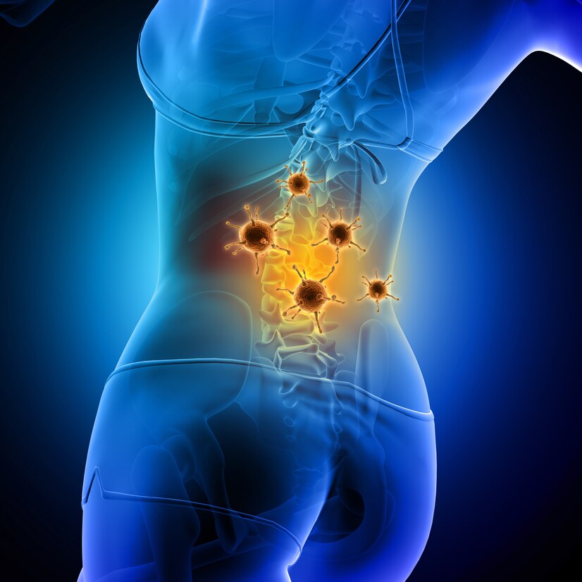 stem cell back treatment