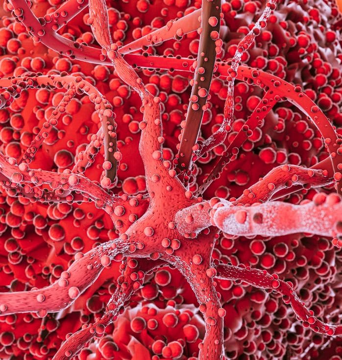multiple myeloma treatment