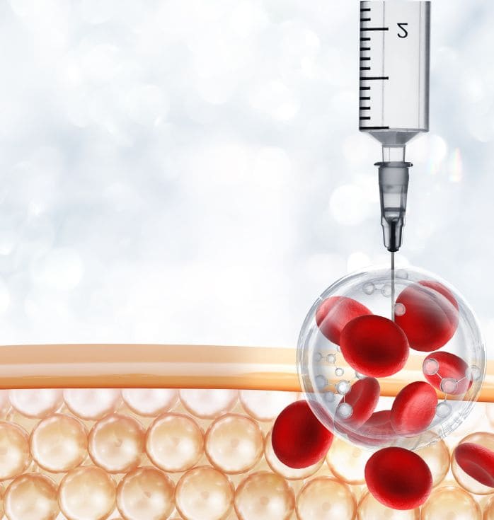 stem cell treatment for diabetes