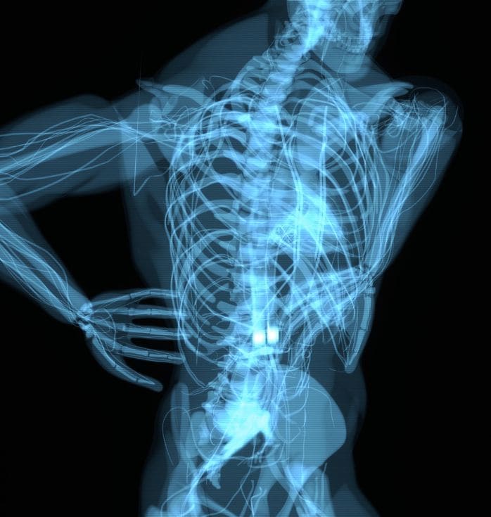stem cell treatment for back pain in mexico