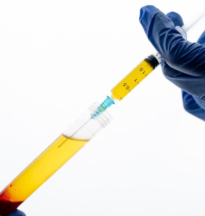 Stem Cell Treatment for Crohn's