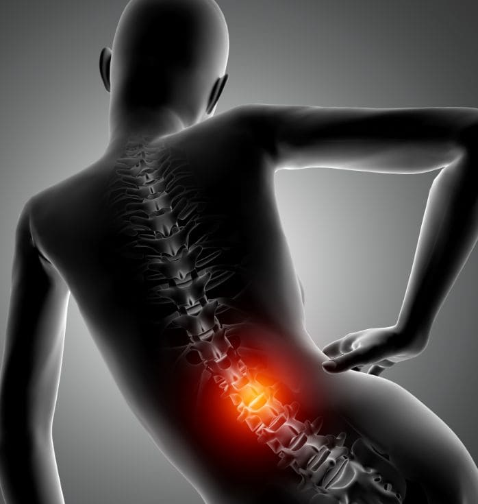 stem cell treatment for sciatica