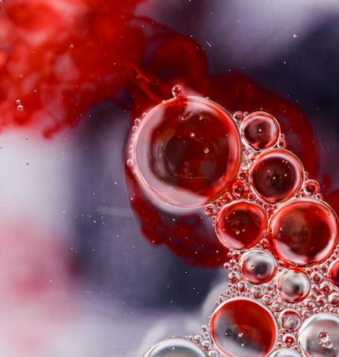 Stem Cell Treatment for Crohn's