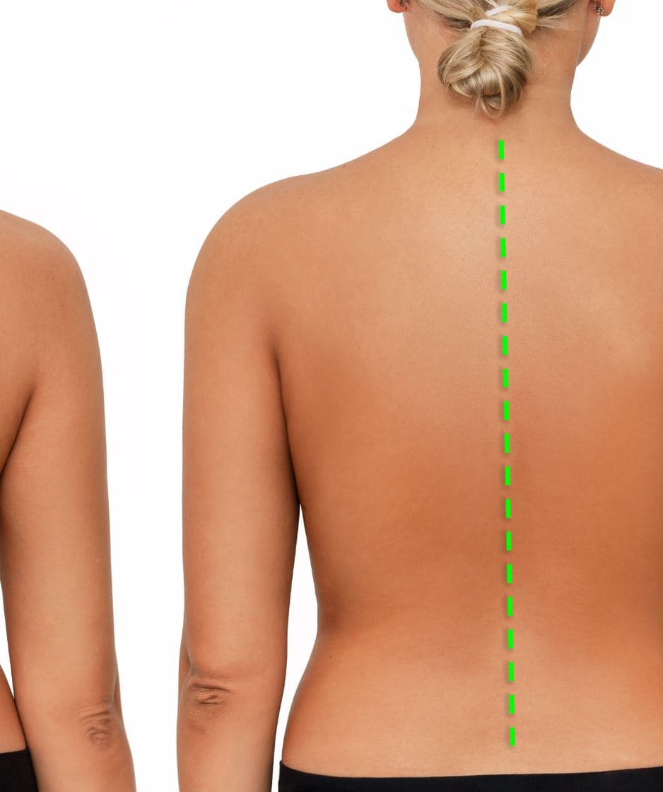stem cell treatment for back pain in mexico