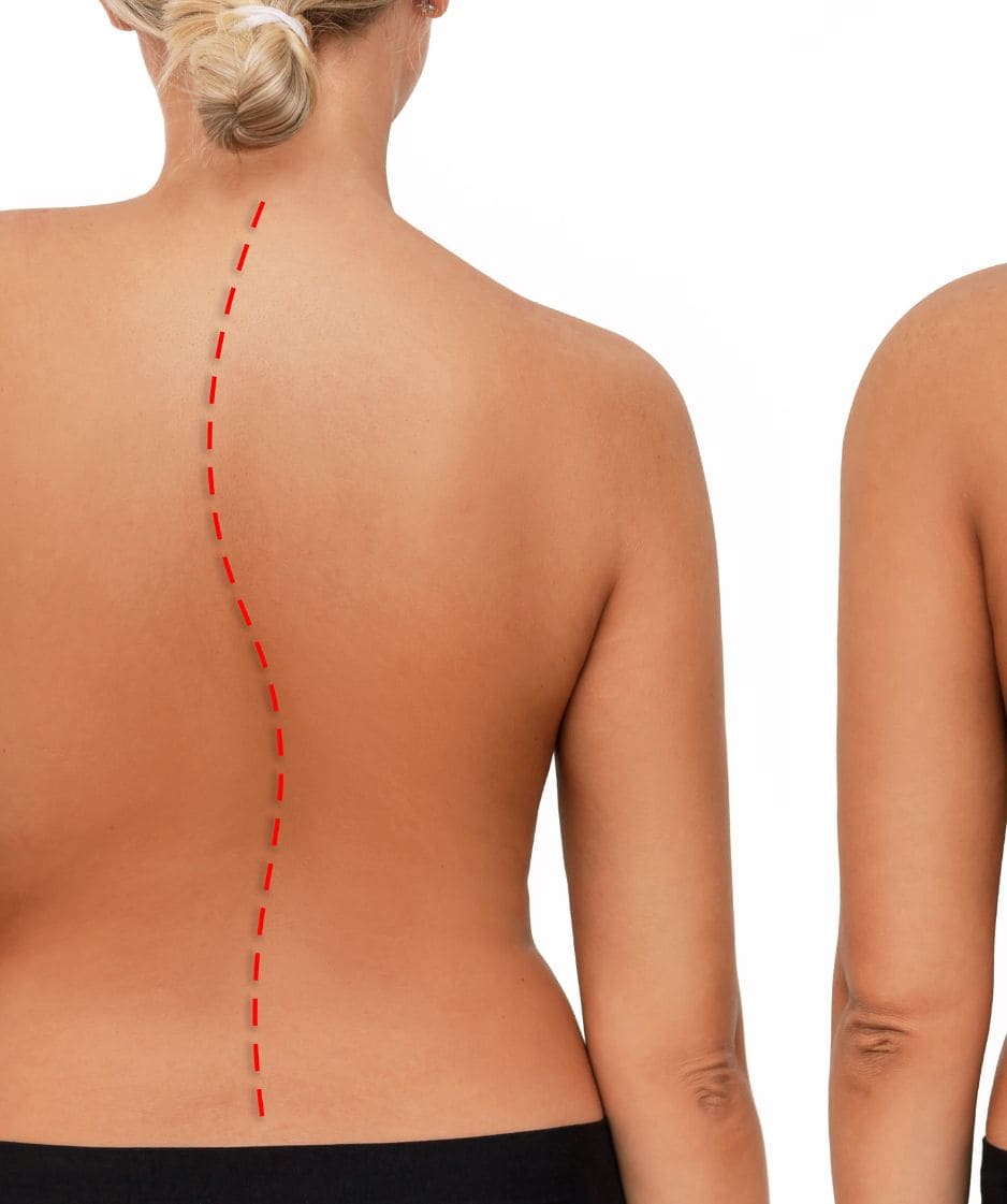 stem cell treatment for back pain in mexico
