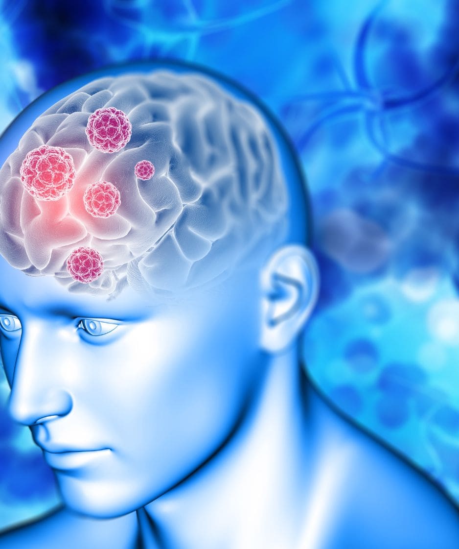 stem cell treatment for dementia