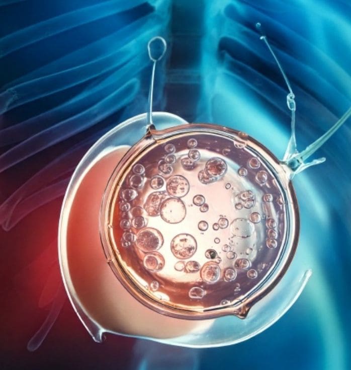 placenta stem cell treatment