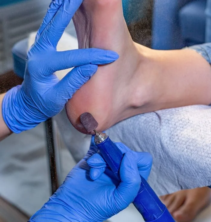 stem cell treatment for foot pain