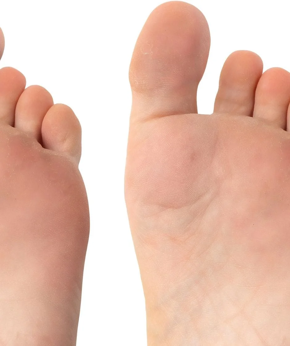stem cell treatment for foot pain