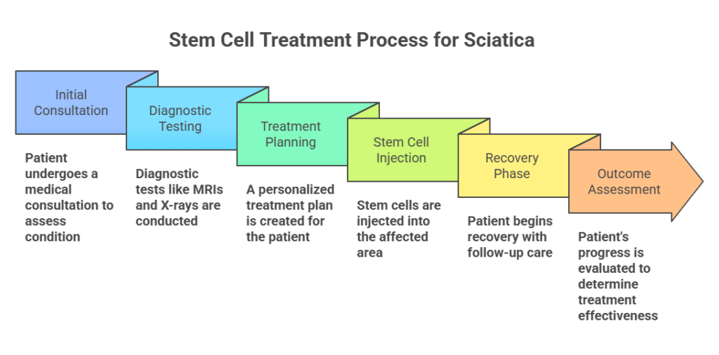 stem cell treatment for sciatica